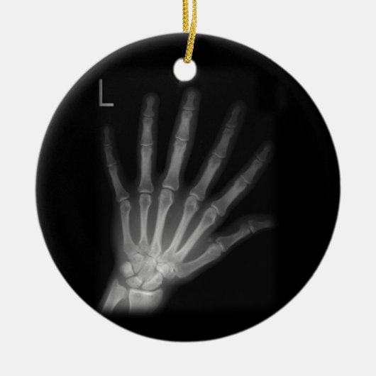 Extra Digit X-ray Left Hand Keramisch Ornament (Voorkant)