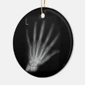 Extra Digit X-ray Left Hand Keramisch Ornament (Links)