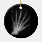 Extra Digit X-ray Left Hand Keramisch Ornament (Achterkant)