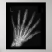Extra Digit X-ray Left Hand Poster (Voorkant)