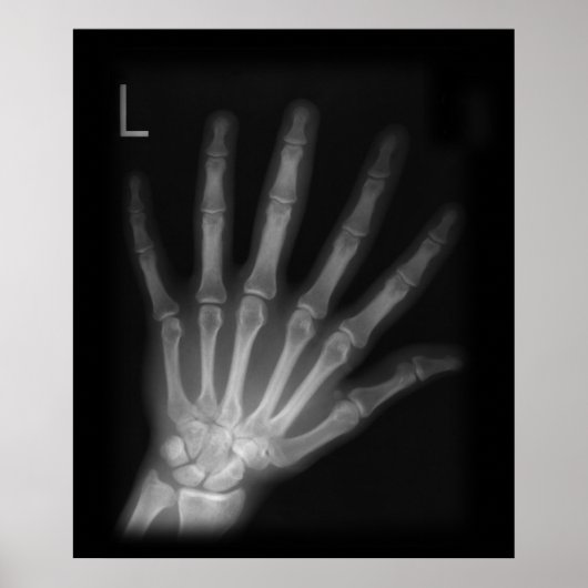Extra Digit X-ray Left Hand Poster (Voorkant)