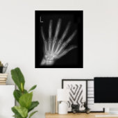 Extra Digit X-ray Left Hand Poster (Thuiskantoor)