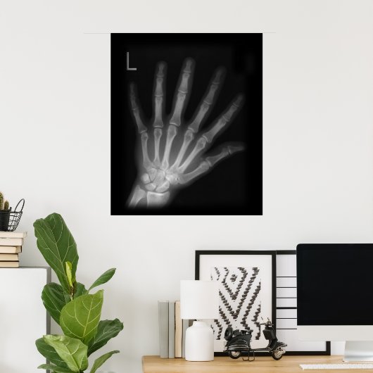 Extra Digit X-ray Left Hand Poster (Thuiskantoor)