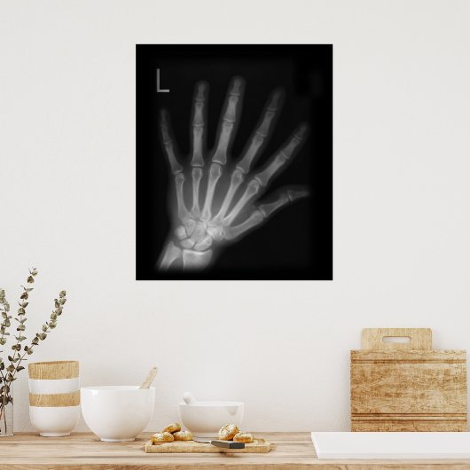 Extra Digit X-ray Left Hand Poster (Keuken)