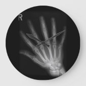 Extra Digit X-ray Right Hand Grote Klok (Voorkant)