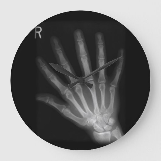 Extra Digit X-ray Right Hand Grote Klok (Voorkant)