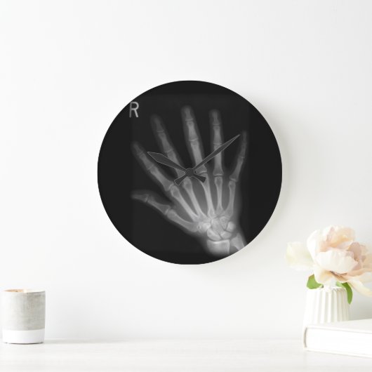 Extra Digit X-ray Right Hand Grote Klok (Huis)