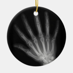 Extra Digit X-ray Right Hand Keramisch Ornament