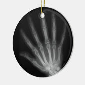 Extra Digit X-ray Right Hand Keramisch Ornament (Links)