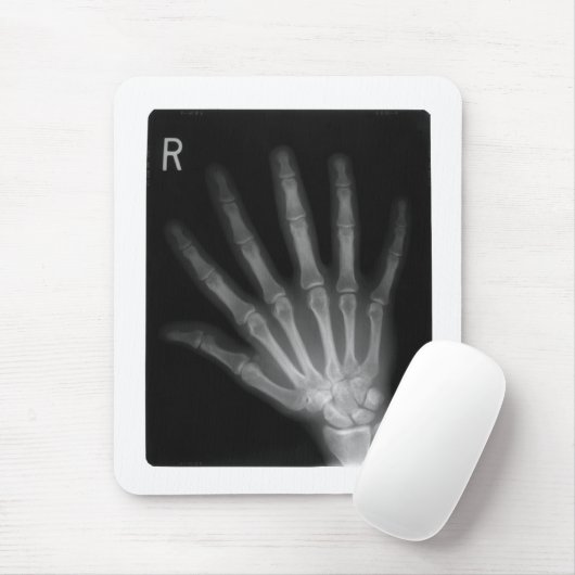 Extra Digit X-ray Right Hand Muismat (Met muis)