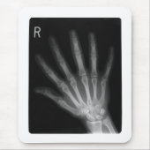 Extra Digit X-ray Right Hand Muismat (Voorkant)