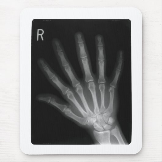 Extra Digit X-ray Right Hand Muismat (Voorkant)