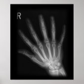 Extra Digit X-ray Right Hand Poster (Voorkant)