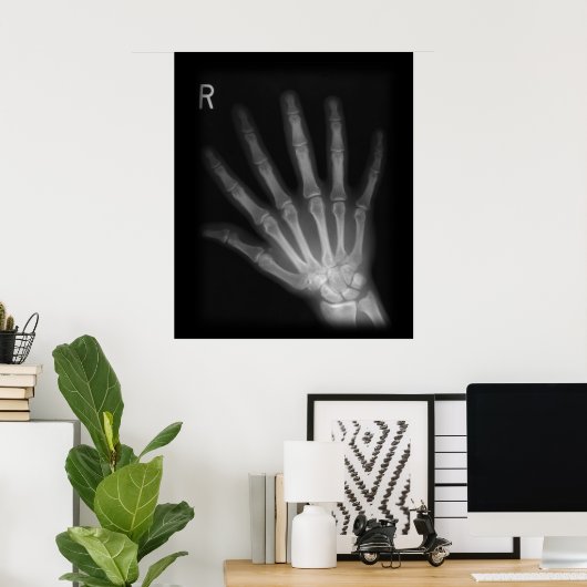 Extra Digit X-ray Right Hand Poster (Thuiskantoor)