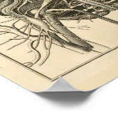 Eyes Brain Cranial Nerves Anatomy Print (Hoek)