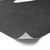 Facial Fat Pad Anatomy Beauty Spa Decor Poster (Hoek)