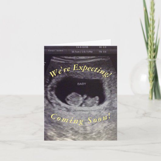 Fake, Prank Zwangerschap (Voorkant)