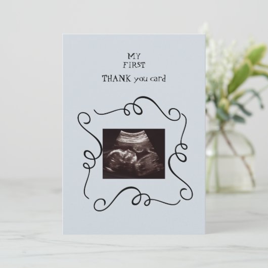 Fantastisch Ultrasound Dank u Baby Punt van Uitzic Bedankkaart (Staand voorkant)