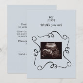 Fantastisch Ultrasound Dank u Baby Punt van Uitzic Bedankkaart (Voorkant / Achterkant)