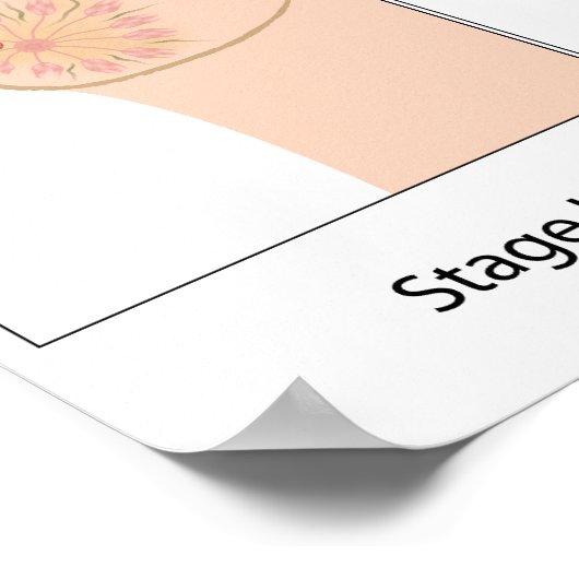 Fasen van het Poster van borstkanker (Hoek)