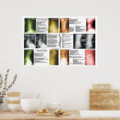 Fases Cerical Lumbar Spinal Degeneration Poster (Keuken)