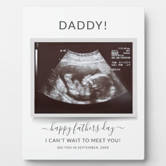Fathers Day Ultrasound Foto's Zwangerschap Pap ont Fotoplaat (Voorkant)