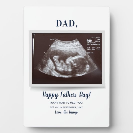 Fathers Day Ultrasound Zwangerschap Aankondiging v Fotoplaat (voorkant)