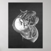 Fetus Womb Anatomy Obstetrics Decor no. 2 Poster (Voorkant)