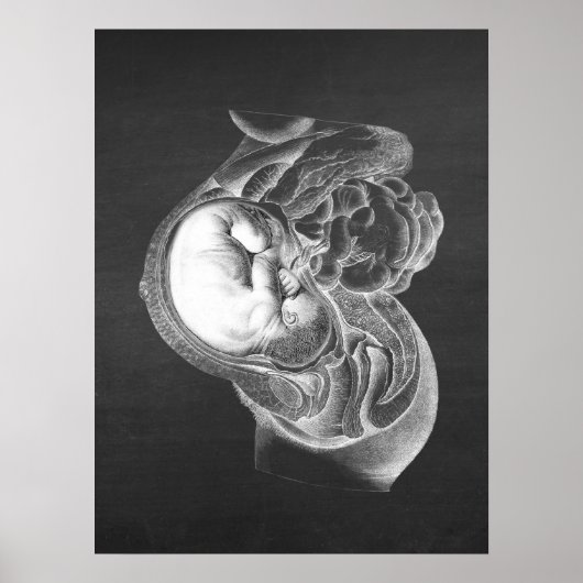 Fetus Womb Anatomy Obstetrics Decor no. 2 Poster (Voorkant)