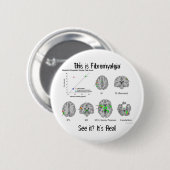 Fibromyalgie is echt. fMRI-bewijs Ronde Button 5,7 Cm (Voorkant /achterkant)