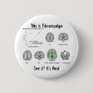 Fibromyalgie is echt. fMRI-bewijs Ronde Button 5,7 Cm