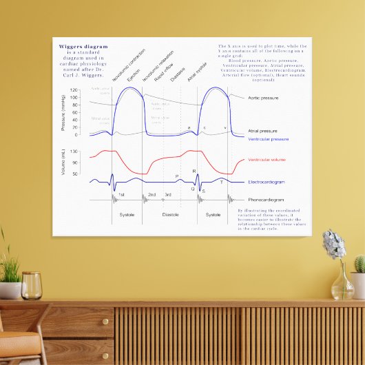 Figuur Canvas Afdruk (Insitu (Woonkamer))