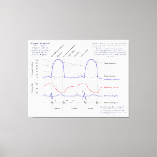 Figuur Canvas Afdruk