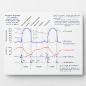 Figuur Fotoplaat (Voorkant)