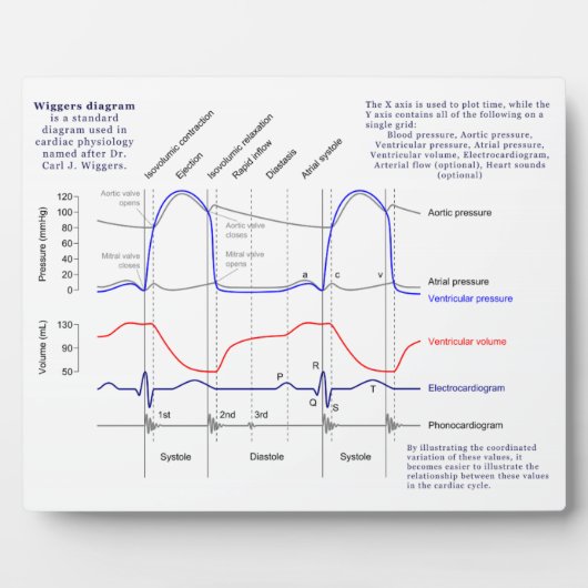 Figuur Fotoplaat (Voorkant)