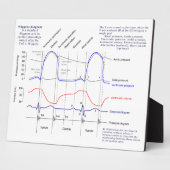 Figuur Fotoplaat (Zijkant)
