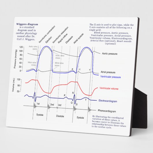 Figuur Fotoplaat (Zijkant)