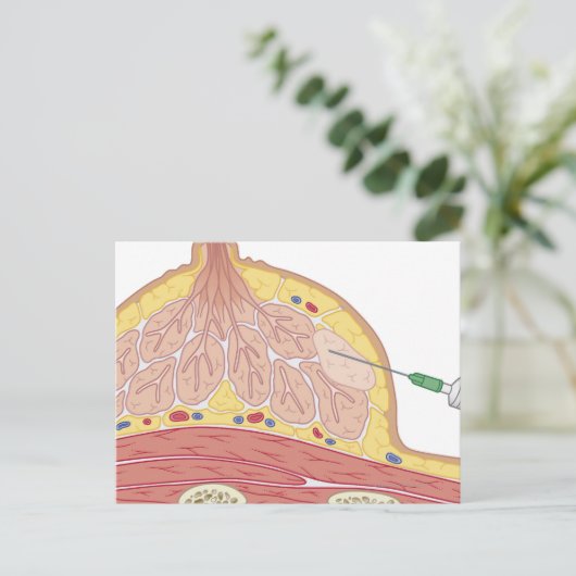 Fijnnaald Aspiratie Briefkaart (Staand voorkant)