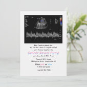 Foetaal doppler Afbeelding Genderkwestie partijuit Kaart (Staand voorkant)