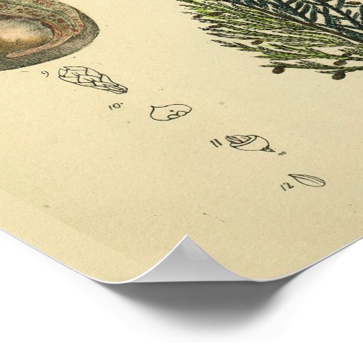 Foetale positie Pelvis Anatomie  Kunst Afdrukken Poster (Hoek)