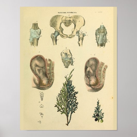 Foetale positie Pelvis Anatomie  Kunst Afdrukken Poster (Voorkant)