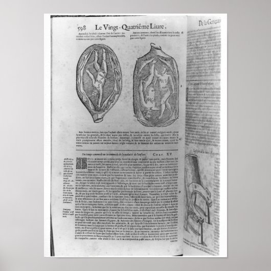 Foetus, illustratie van "Oeuvres" Poster (Voorkant)