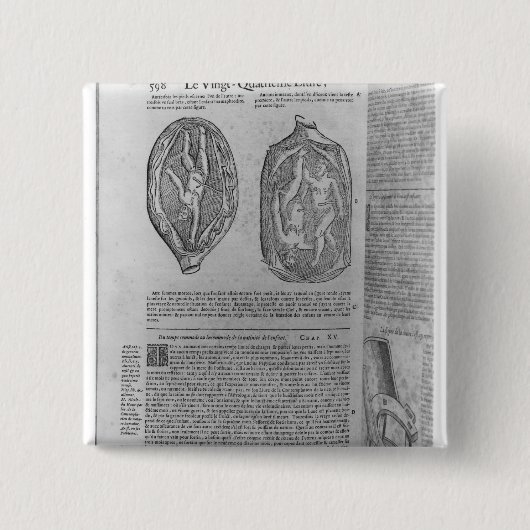 Foetus, illustratie van "Oeuvres" Vierkante Button 5,1 Cm (Voorkant)