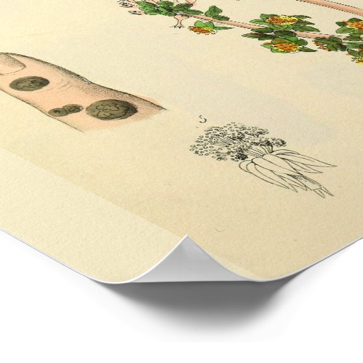 Foetus Positie Uterus  Anatomie Art Print (Hoek)