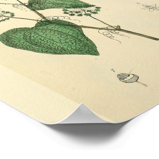 Foetus Uterus anatomie Art Print (Hoek)