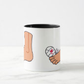 Foot-2 Broken Toe Mok (Midden)