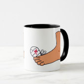 Foot-2 Broken Toe Mok (Voorkant rechts)