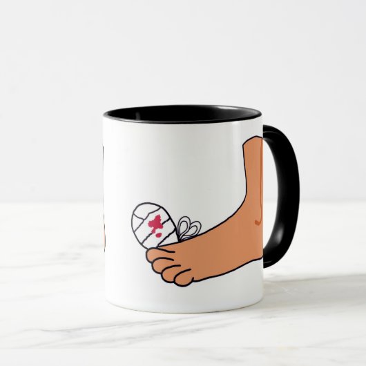 Foot-2 Broken Toe Mok (Voorkant rechts)