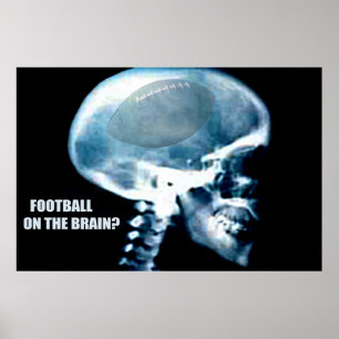 Football kop (röntgenfoto) poster