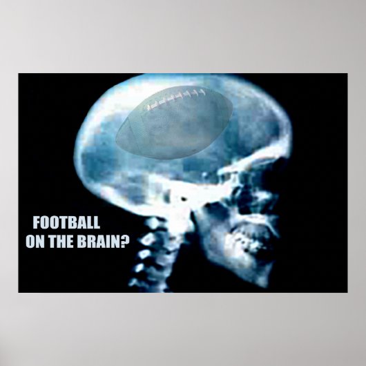 Football kop (röntgenfoto) poster (Voorkant)
